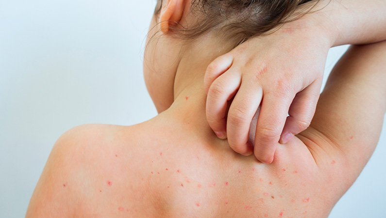 Young patient with irritable skin