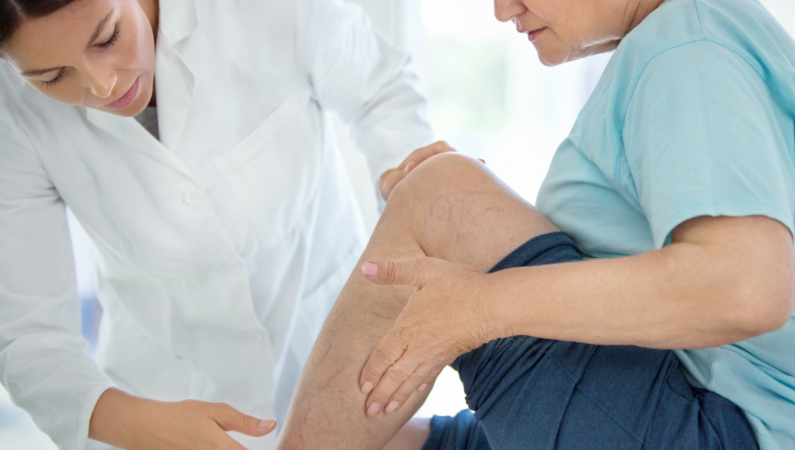 Provider examination veins on patient's legs