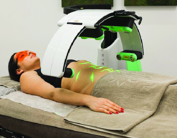 Woman laying on medical table receiving Emerald Laser treatment.